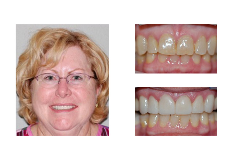 Family Dentist in San Antonio