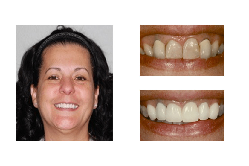 San Antonio Cosmetic Dentist