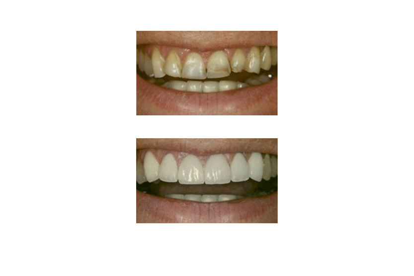 Family Dentist in San Antonio