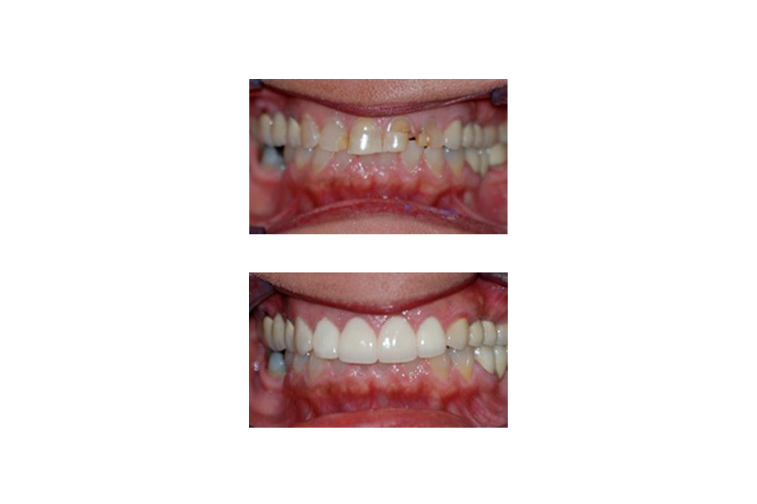 Emergency Dentist San Antonio