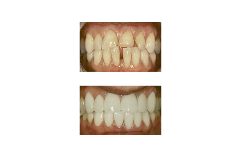 Cosmetic Dental Office San Antonio