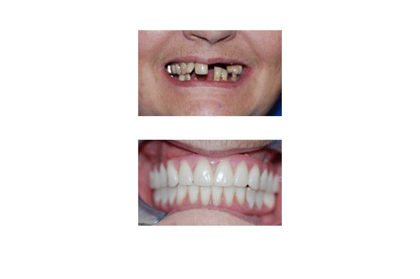 Emergency Dentist San Antonio