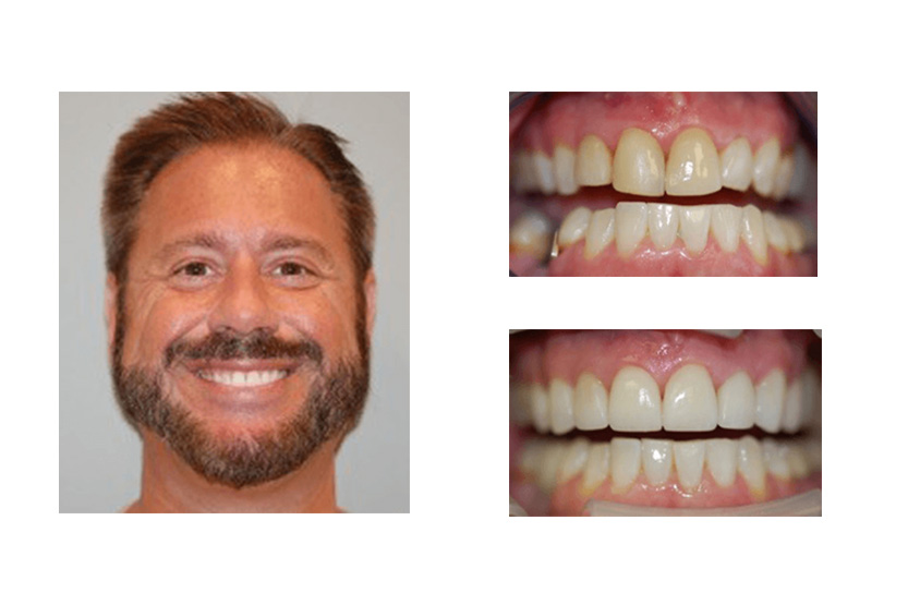 San Antonio Cosmetic Dentist