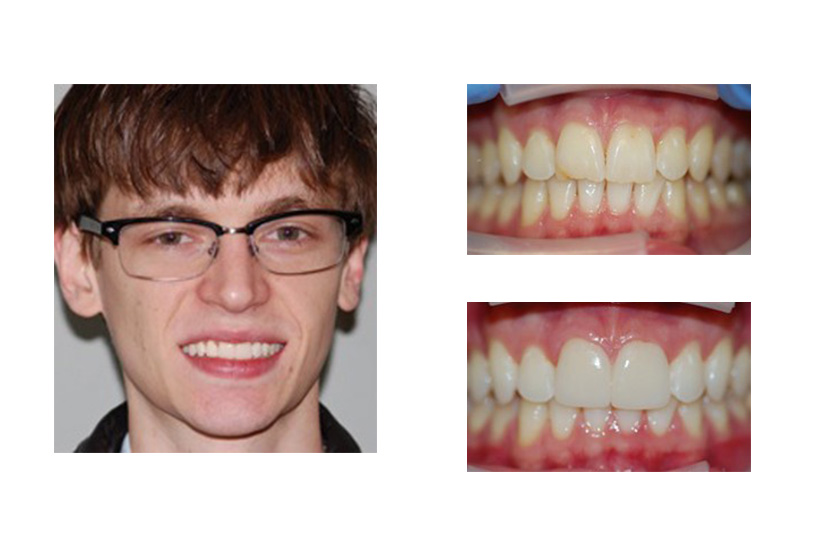 Cosmetic Dental Office San Antonio