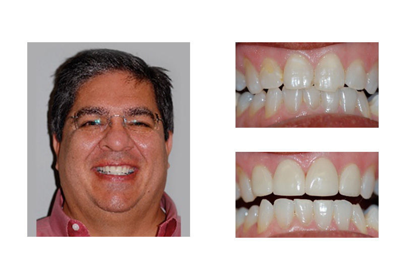 Dentist in San Antonio