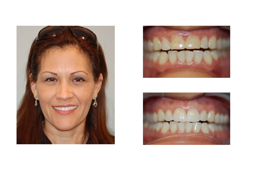 Cosmetic Dental Office San Antonio