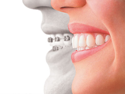 New Image Dentistry | A.I. X-Rays, Intraoral Camera and Sedation Dentistry