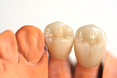 New Image Dentistry | Dentures, Pediatric Dentistry and Preventative Program