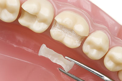 New Image Dentistry | Ceramic Crowns, Pediatric Dentistry and A.I. X-Rays