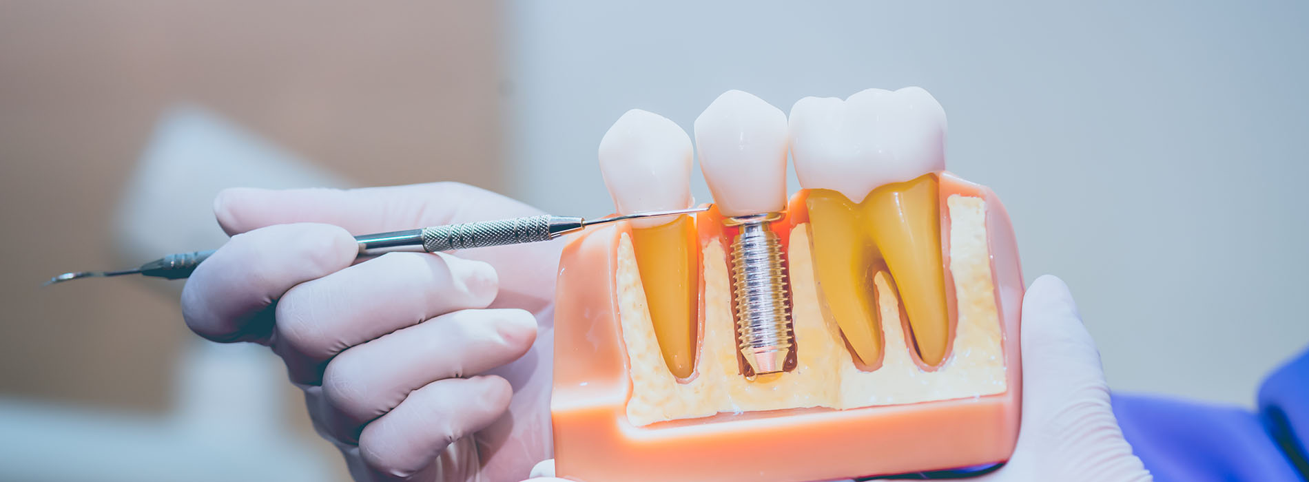 New Image Dentistry | Root Canals, Extractions and Pediatric Dentistry
